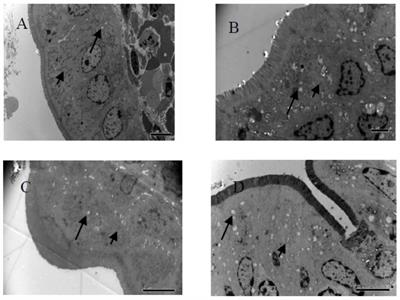 Reduced-Fat Response of Lactobacillus casei subsp. casei SY13 on a Time and Dose-Dependent Model